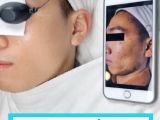 TRỊ LIỆU SẸO RỖ CHUYÊN SÂU ĐA PHƯƠNG PHÁP