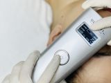 HIFU ULTIGHT LIFT XÓA NHĂN - NÂNG CƠ - TRẺ HÓA DA CHUYÊN SÂU